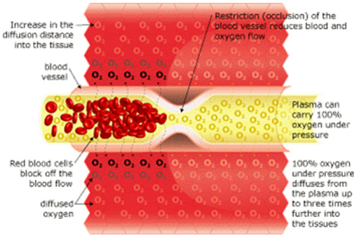 hyperbarics_04