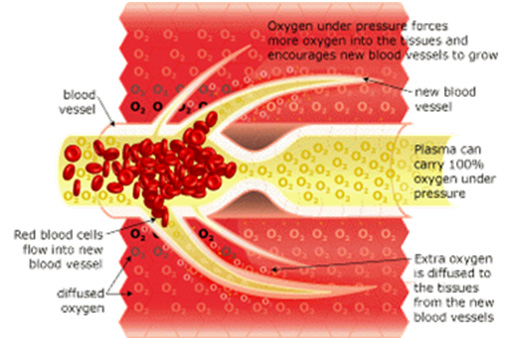 hyperbarics_05