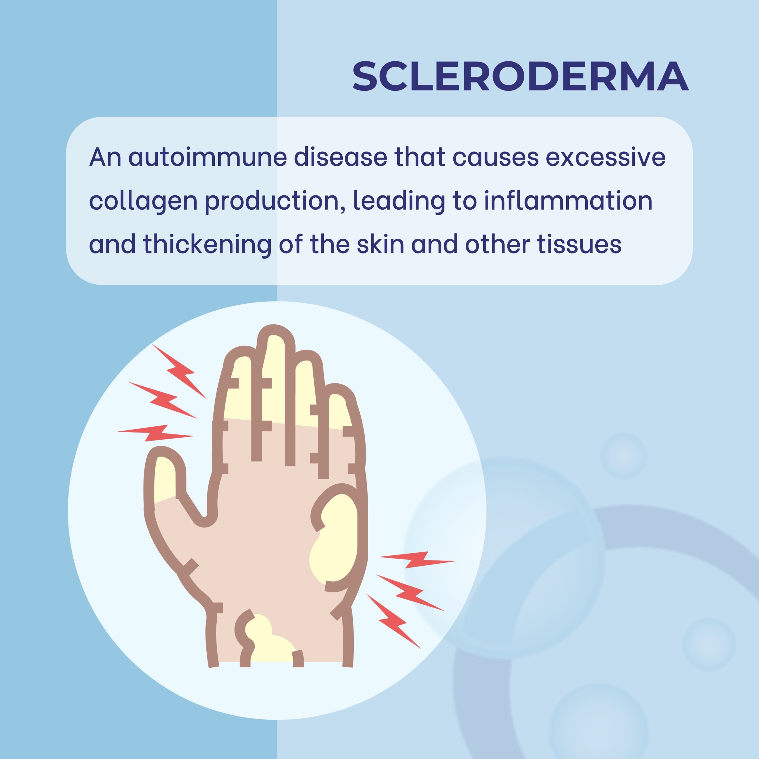 glutathione and scleroderma Adding Glutathione to your Autoimmune